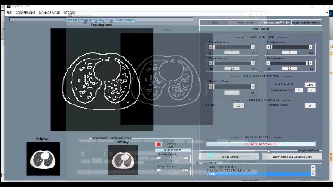 Top Digital Image Processing Projects with MATLAB 🚀