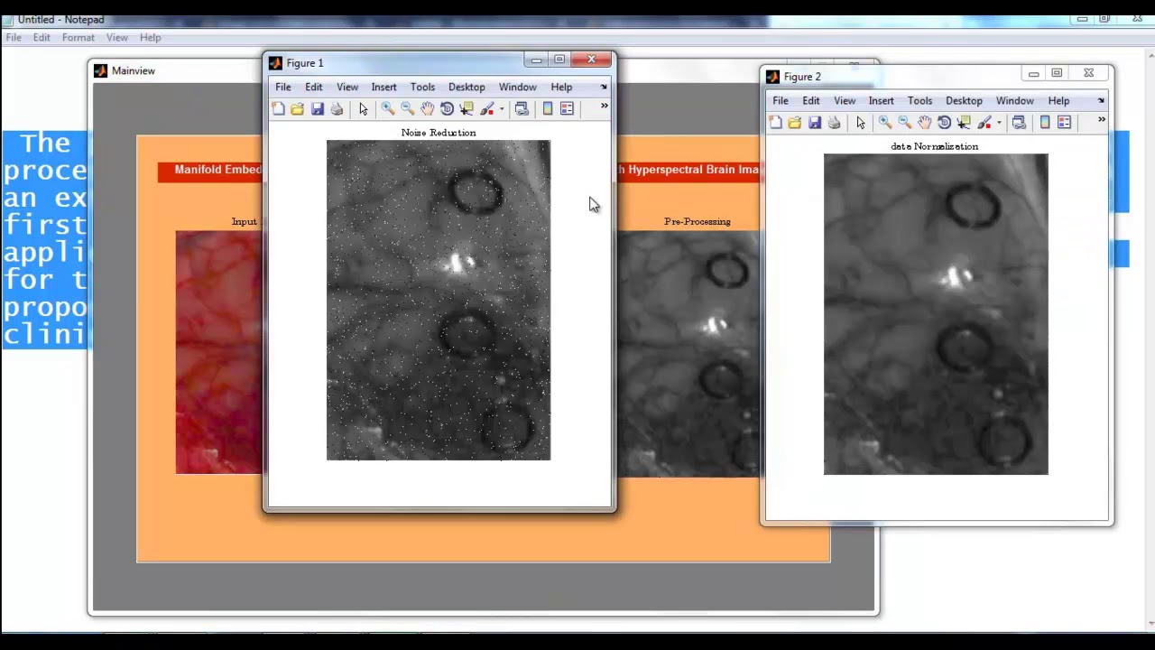 Digital Image Processing Project Using MATLAB π·