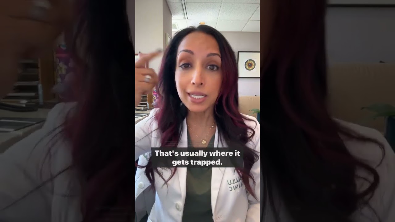 Stuck Contact Lens? Quick Tips to Remove It 😵