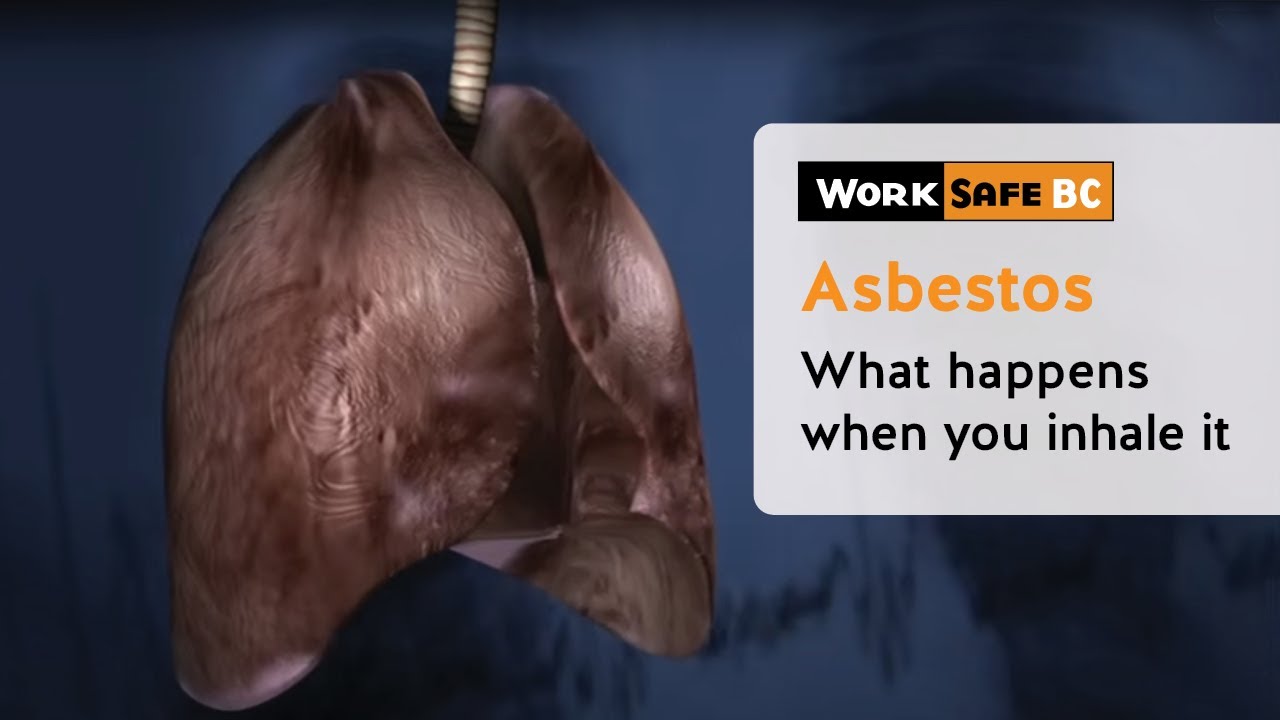 Understanding Asbestos Risks: How Fibres Damage Your Lungs 🩺