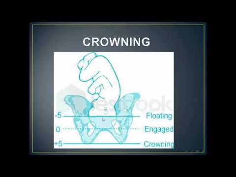 Fetal Crowning & Labor Management 🤰