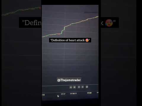 Definition oF Heart Attck?💔💀📉😂#trading #memecoin #crypto #rugpull #cryptomemes