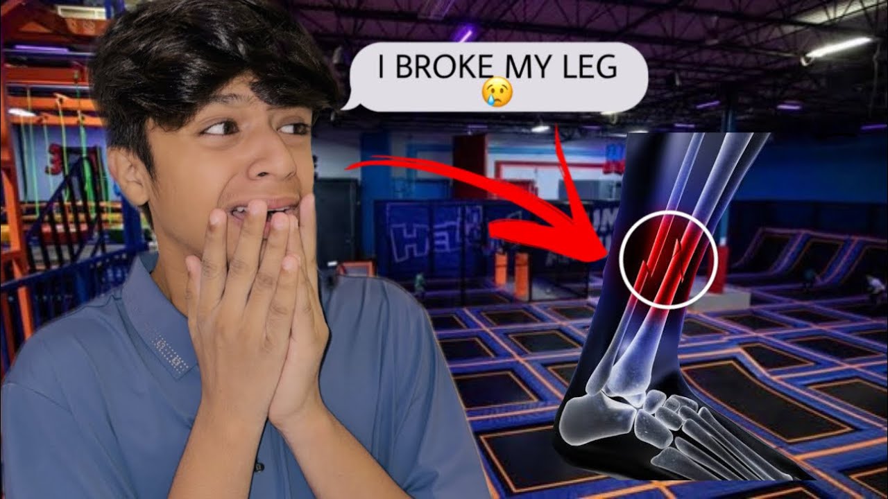 Jumping Mishap Causes Leg Bone Injury 😢