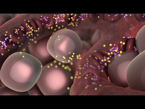 Type 1 Diabetes Explained 🩺
