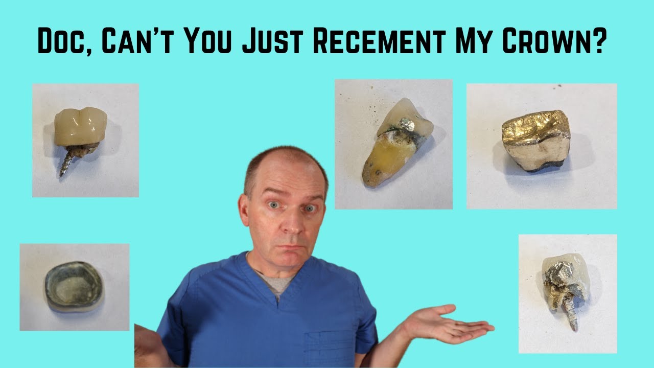 How to Recement a Dental Crown 🦷