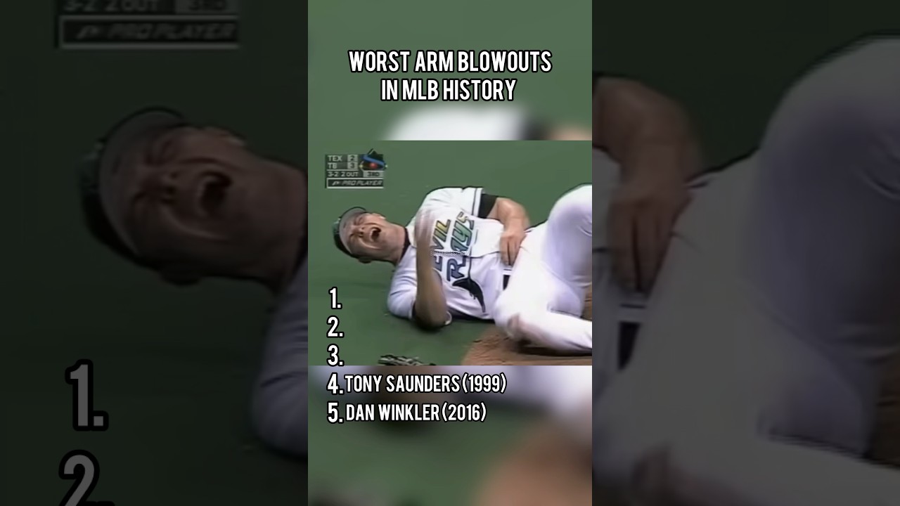 Top 10 Most Shocking Arm Blowouts in MLB History ⚾