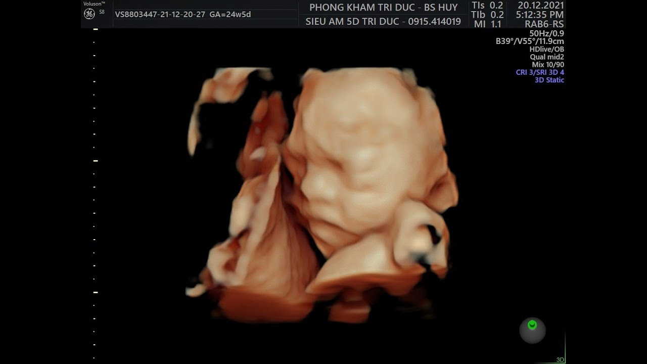 Understanding the Number 51424