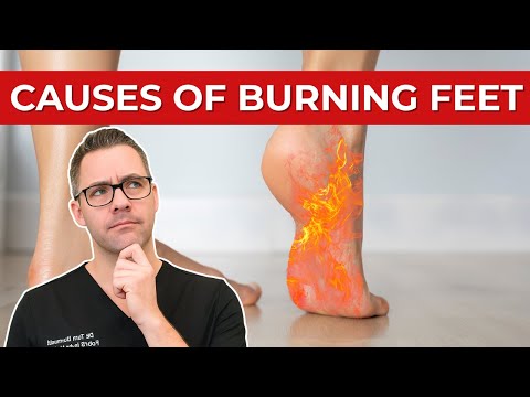 Top 11 Causes of Burning Feet & Peripheral Neuropathy [Instant FIX?]