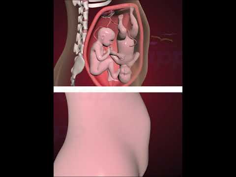 Precious Twins fight inside the Womb (3D animation )