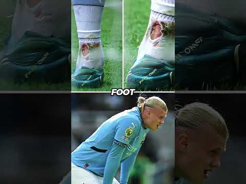 Erling Haaland missed a penalty and got injured ending his season 😞💔