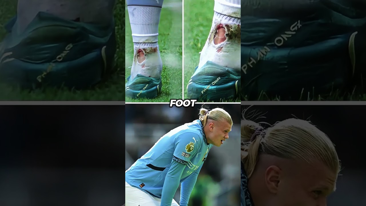 Haaland Misses Penalty and Sustains Injury, Ending His Season 😞