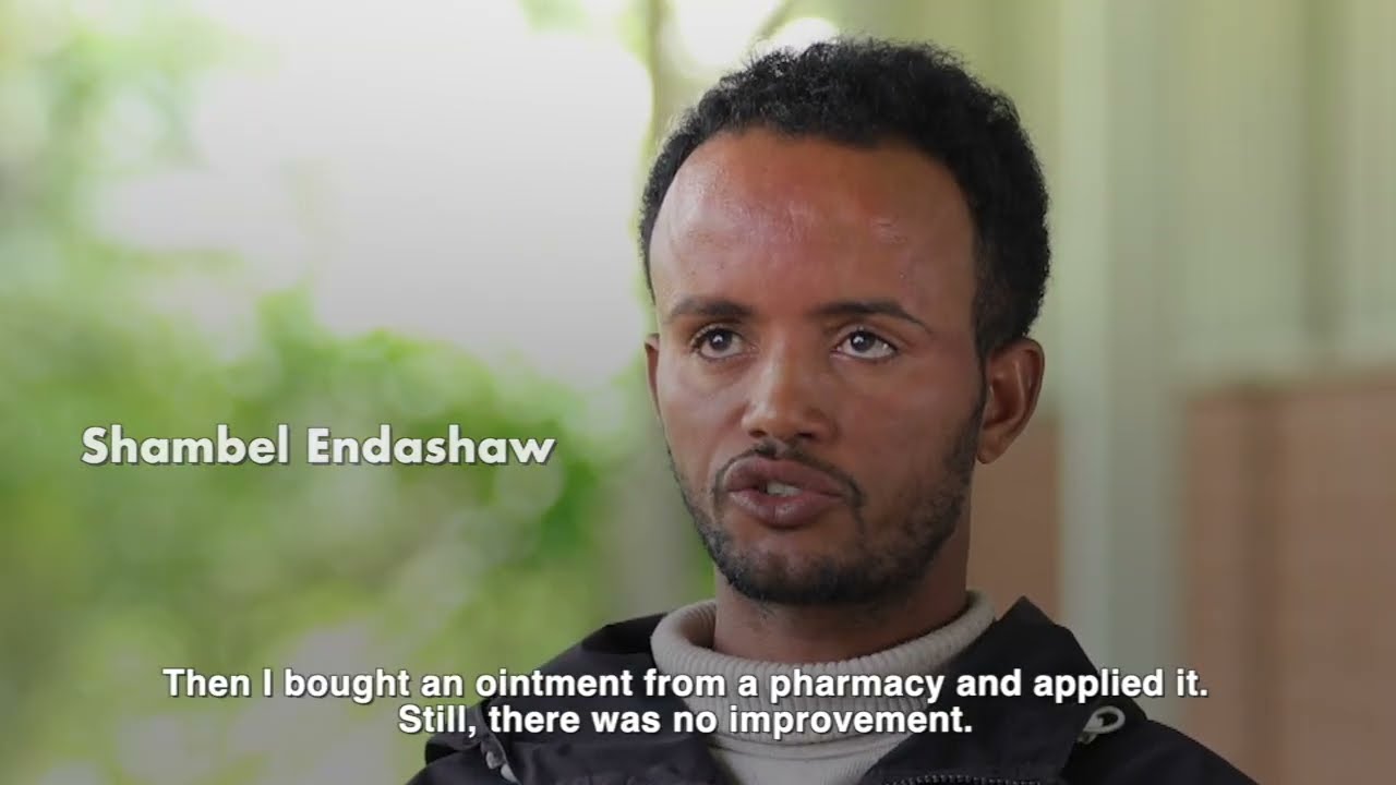 Ethiopia Boosts Leprosy Detection for Early Diagnosis 🩺