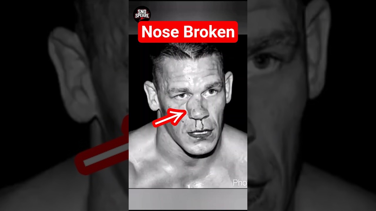 Top 3 Wrestlers Injured by Seth Rollins ⚠️