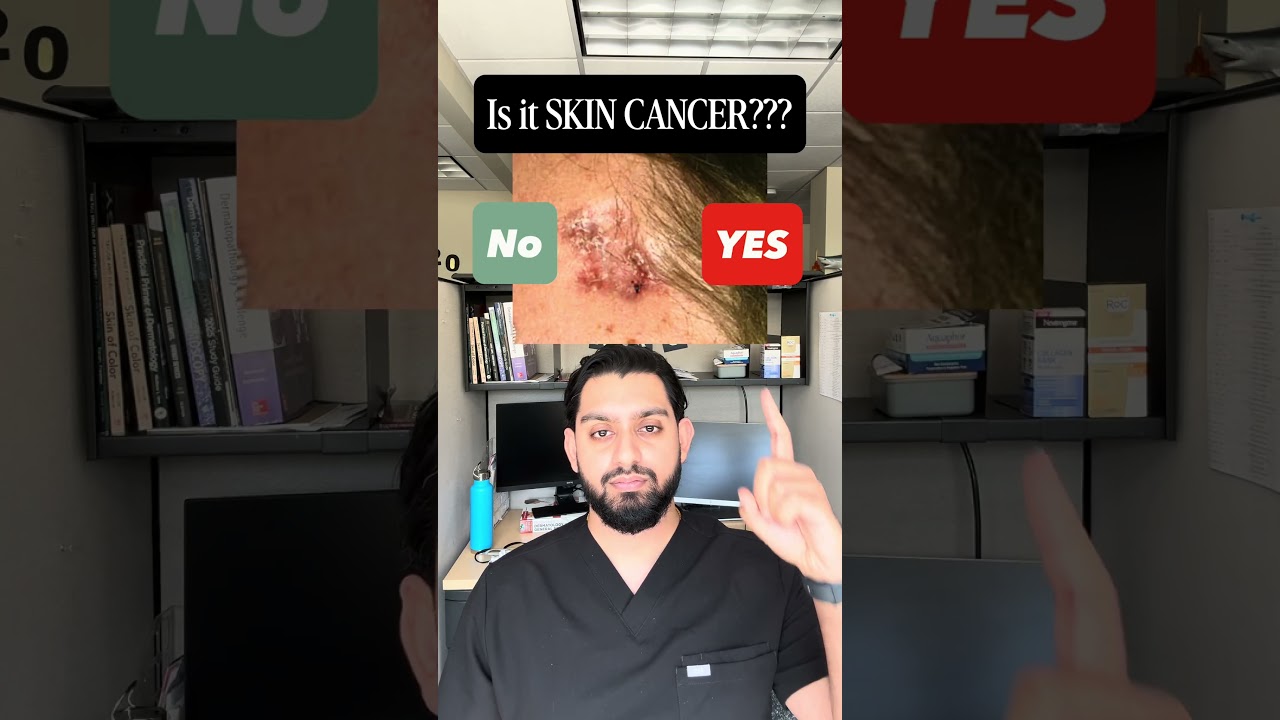 Skin cancer or not??? Dermatology Resident Physician Highlights 3 cases