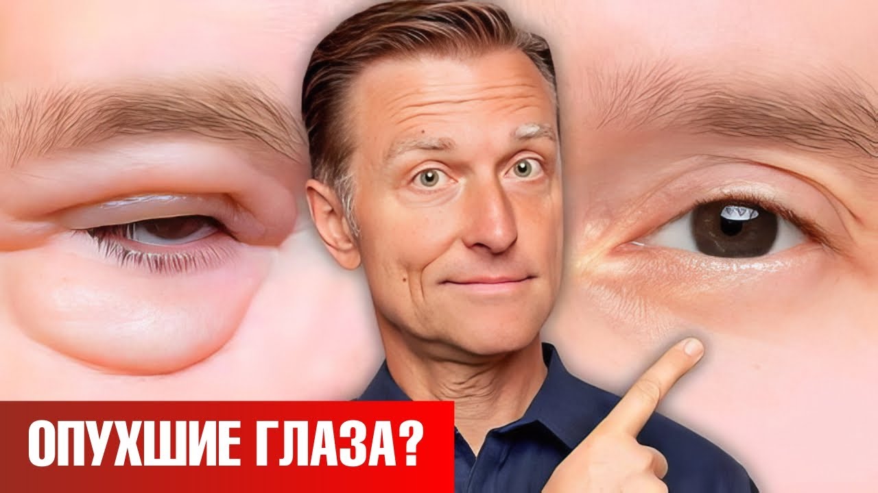 Как избавиться от мешков под глазами навсегда 🧐