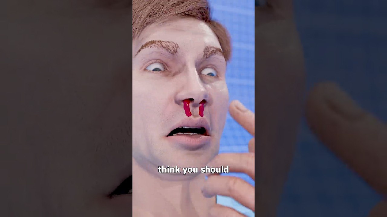 Quick & Easy Steps to Stop a Nosebleed 🩸