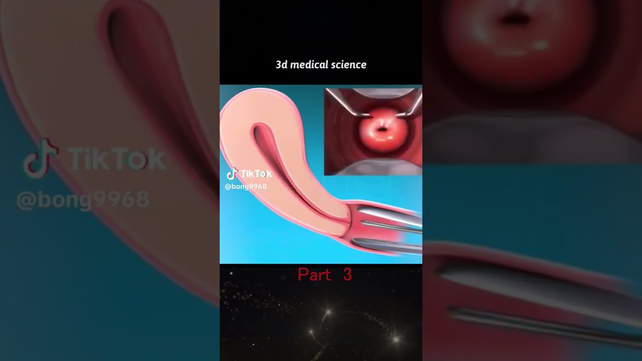 3D Medical Imaging for Vaginal, Uterus & Pregnancy Care 🩺