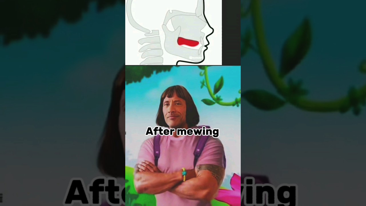 Amazing Mewing Transformation: See the Incredible Results! 😮