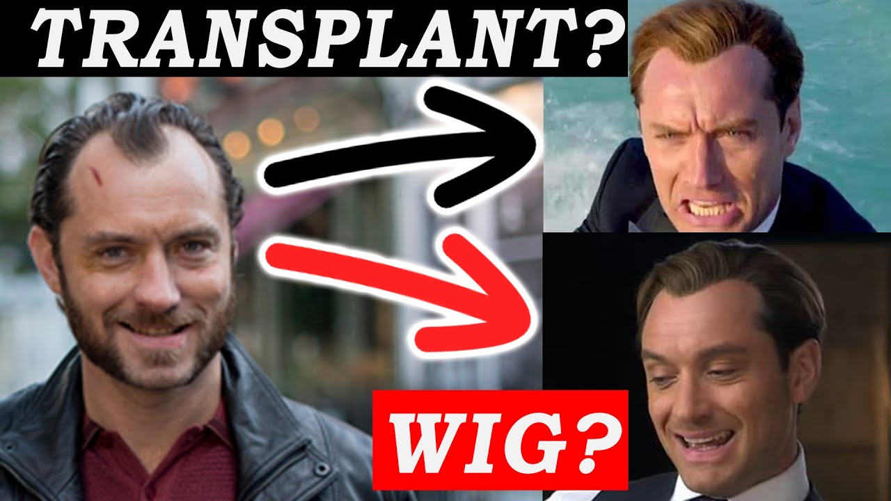 Jude Law's Hair Transformation: Transplant or Not? 🤔
