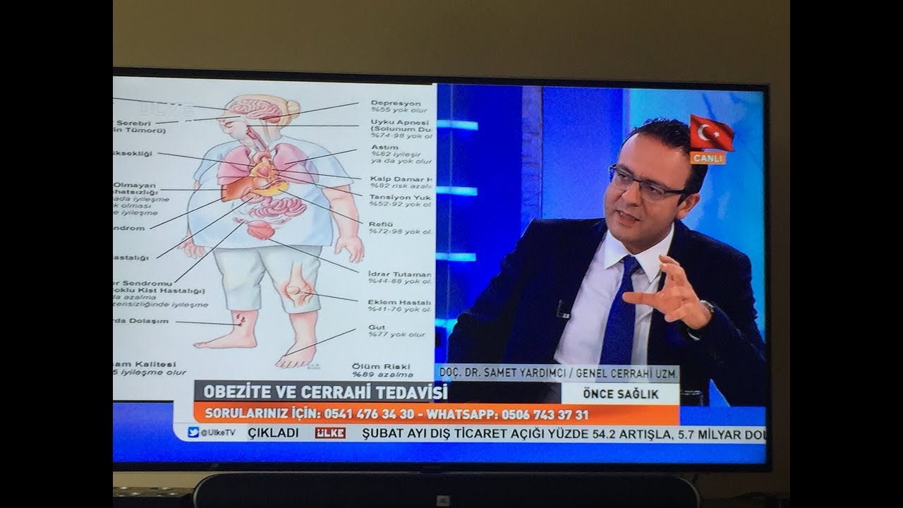 Ülke TV’de Önce Sağlık: Obezite ve Diyabet Cerrahisinde Uzman Görüşleri 🩺