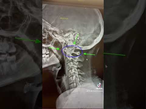 It’s me. I’m the problem. An ATLAS MISALIGNMENT!