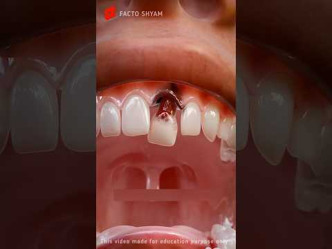 Can a Tooth Digest? Explained with 3D Animation! #shorts