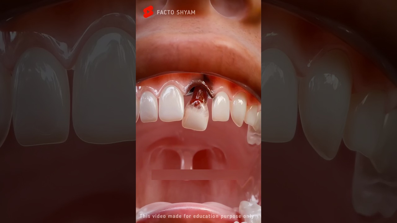 Can a Tooth Digest? Explained with 3D Animation 🦷