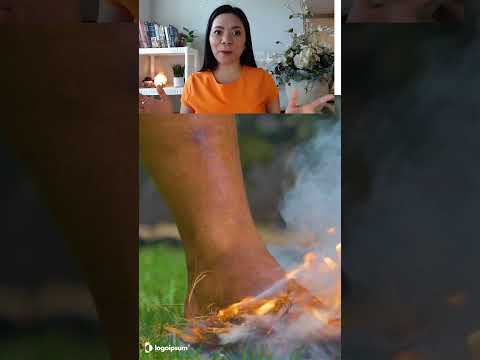 Are your feet burning and feel like they are on fire? Could it be neuropathy?