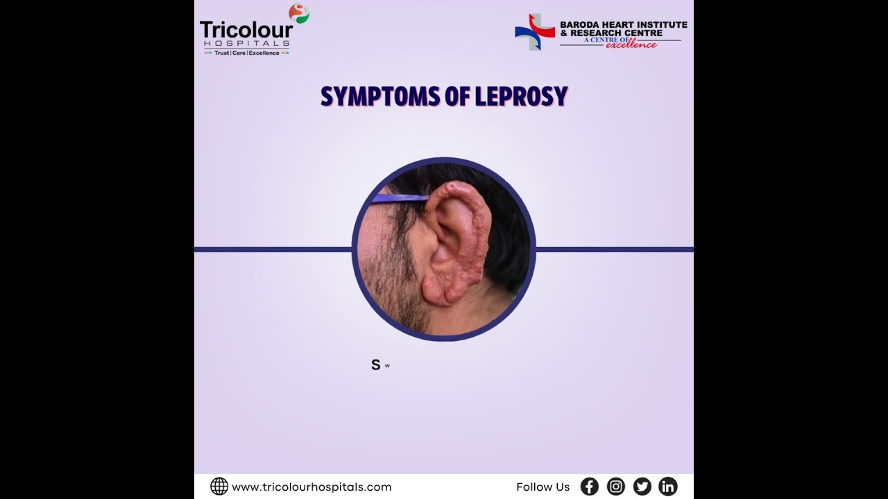 Leprosy Awareness: Fight Discrimination ✊