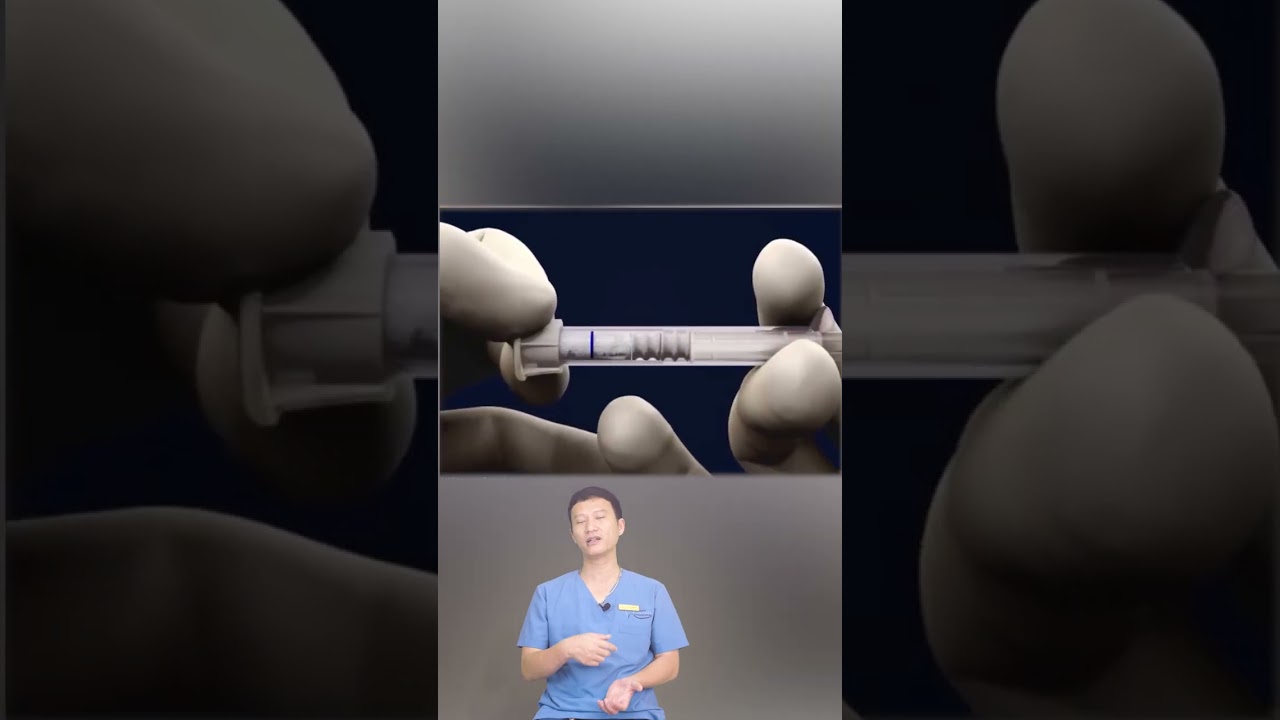 Nguy Hiểm Khi Nhổ Răng Thủng Xoang ⚠️