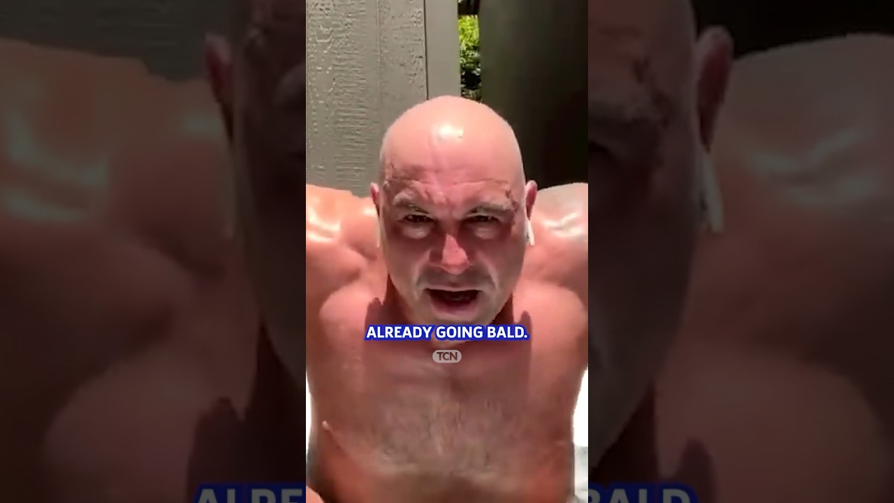 Should You Go Bald When Losing Hair? 🤔