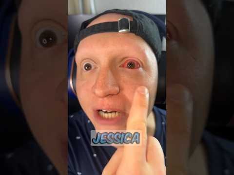When you have pink eye #comedy #funny #gamer #relatable #skit