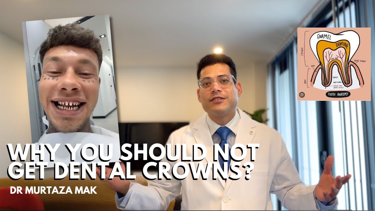 Reasons to Avoid Dental Crowns ⚠️