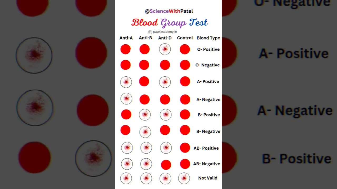 Get Accurate Blood Group Test Results Today 🩸