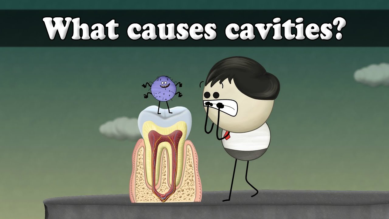 What Causes Cavities? 🦷