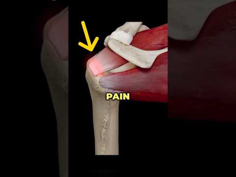 Fix Rotator Cuff Pain from the Supraspinatus #fixshoulderpain #shoulderinjury