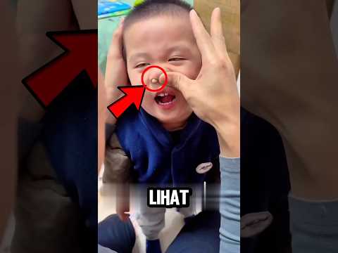 Lucu dan Menggemaskan! Anak Ini Tanpa Sengaja Masukkan Biji Buncis ke Hidungnya 😄