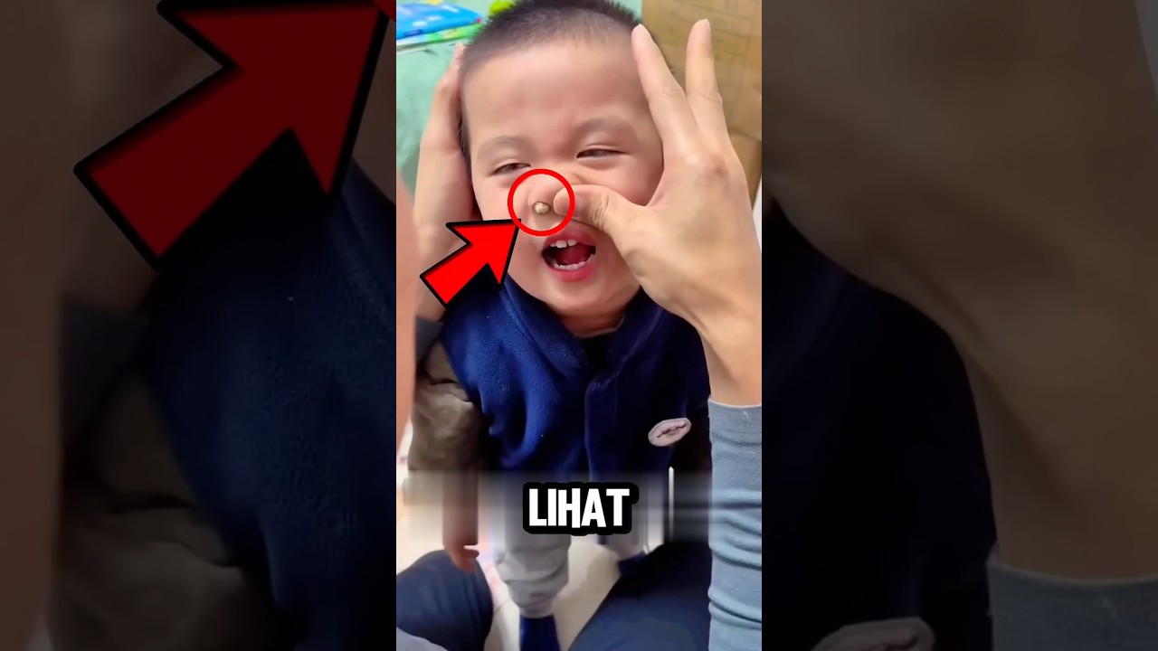 Lucu dan Menggemaskan! Anak Ini Tanpa Sengaja Masukkan Biji Buncis ke Hidungnya 😄