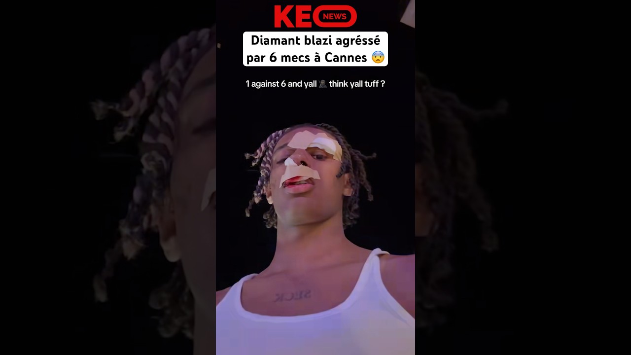 Attaque Violente de Diamant Blazi par 6 Individus au Festival de Cannes 😱