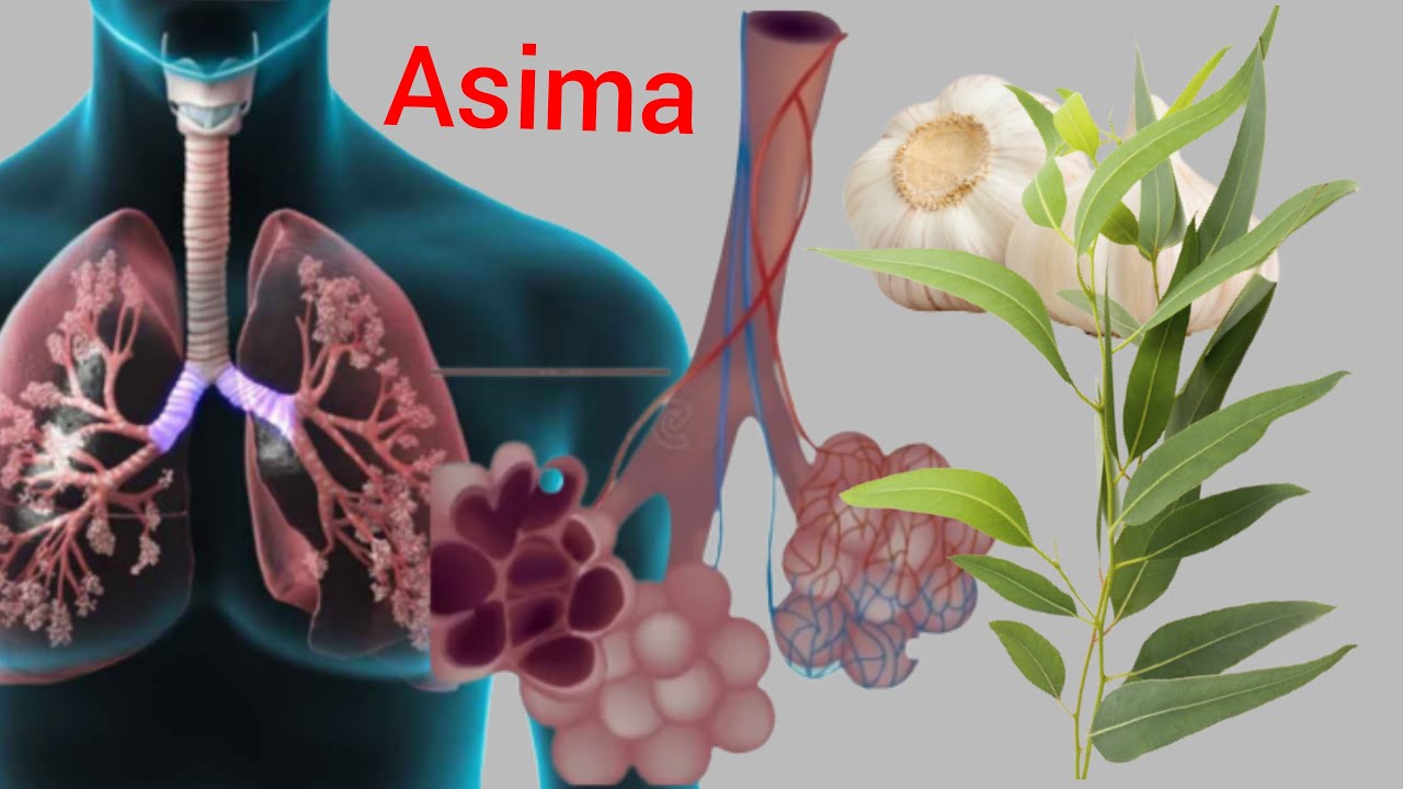 Indwara ya Asima: Ukowayirinda n'Umuti 🩺