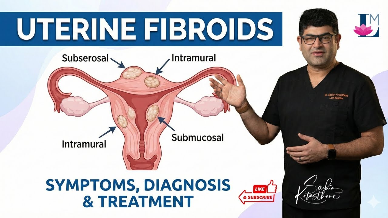 How to Shrink Uterine Fibroids Naturally: Best Home Remedies & Diet Tips for Relief | Lotus Medics