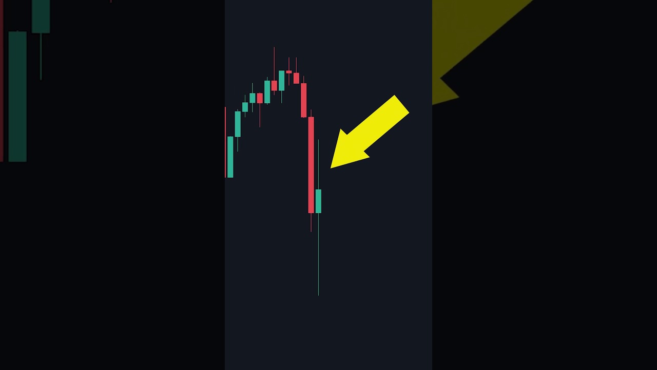 Mastering the Perfect Stop Loss Strategy 📉