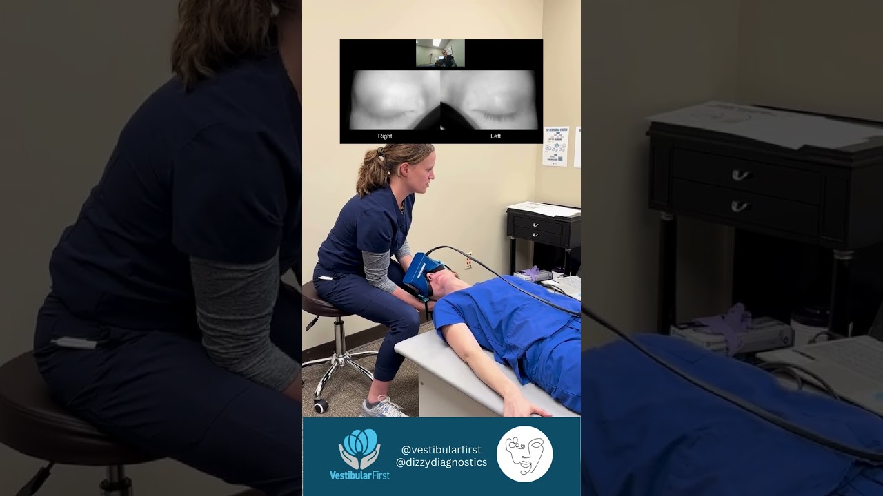 Posterior Canal BPPV Nystagmus Explained