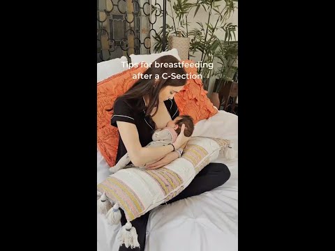 Tips for breastfeeding after a C-Section