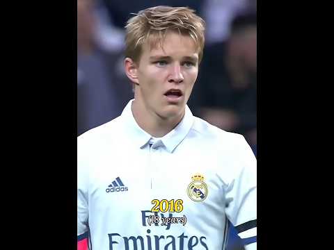 Martin Odegaard Through the Years 2013-2024 Evolution