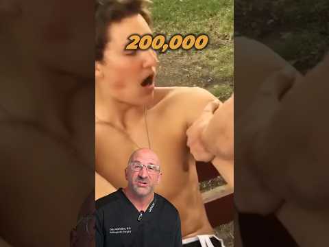 When Your Shoulder Pops 💥 Out #shorts