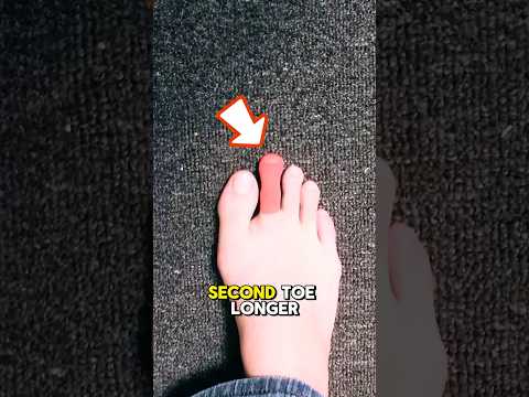 Why Is Your Second Toe Longer Than the Big Toe? The Truth About Morton’s Toe!