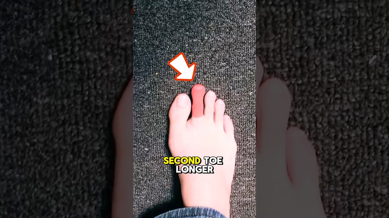 Why Is Your Second Toe Longer Than Your Big Toe? Discover the Truth About Morton's Toe 👣