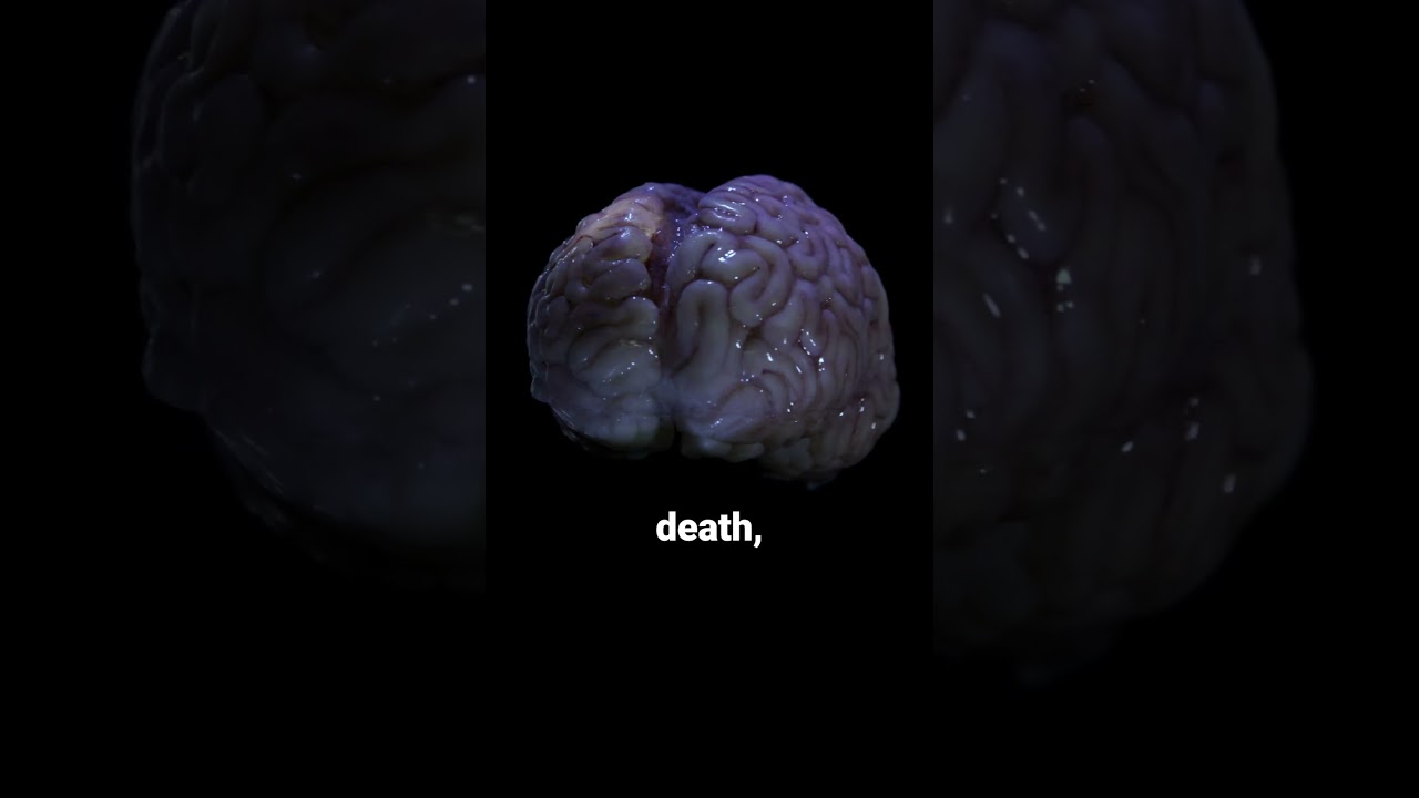 Your Brain Remains Active After Death
