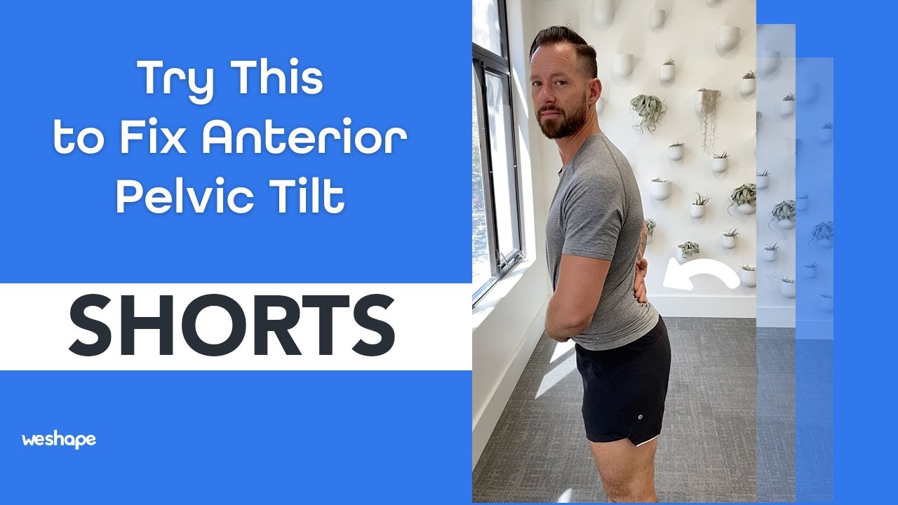 Fix Anterior Pelvic Tilt with This Simple Movement! 🔧 #shorts